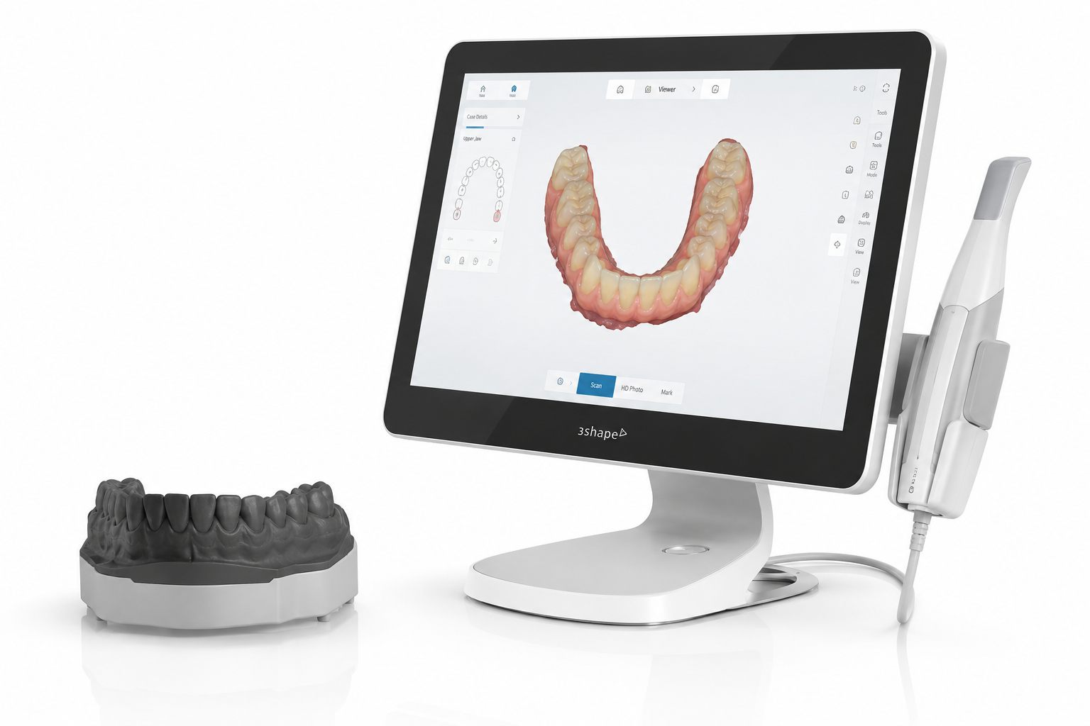 Escáner intraoral digital con modelo 3D de una arcada dental
